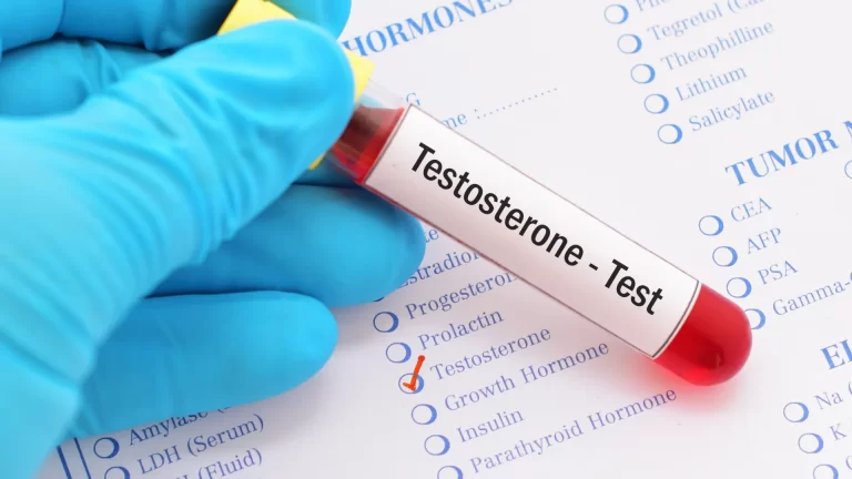 Top 7 At-Home Testosterone Testing Kits Reviewed