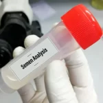 Assessing Semen Health: Important Indicators to Monitor