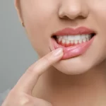 Leaky Gum: Understanding Gingival Permeability